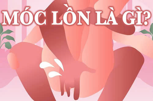 Móc lồn là gì?
